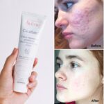 کرم ترمیم کننده سیکالفیت اون _ Avene Cicalfate Antibacterial Repairing Protective Cream - Image 2