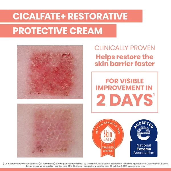 کرم ترمیم کننده سیکالفیت اون _ Avene Cicalfate Antibacterial Repairing Protective Cream - Image 17