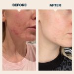کرم ترمیم کننده سیکالفیت اون _ Avene Cicalfate Antibacterial Repairing Protective Cream - Image 11