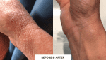 کرم ترمیم کننده سیکالفیت اون _ Avene Cicalfate Antibacterial Repairing Protective Cream - Image 13