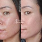 کرم ترمیم کننده سیکاپلاست لاروش پوزای - Image 8