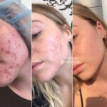کرم ترمیم کننده سیکاپلاست لاروش پوزای - Image 4