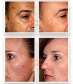 کرم ضد آفتاب ضد لک با محافظت فوق العاده بالا و SPF 50 + آکسول آرسی کازمتیک - Image 3
