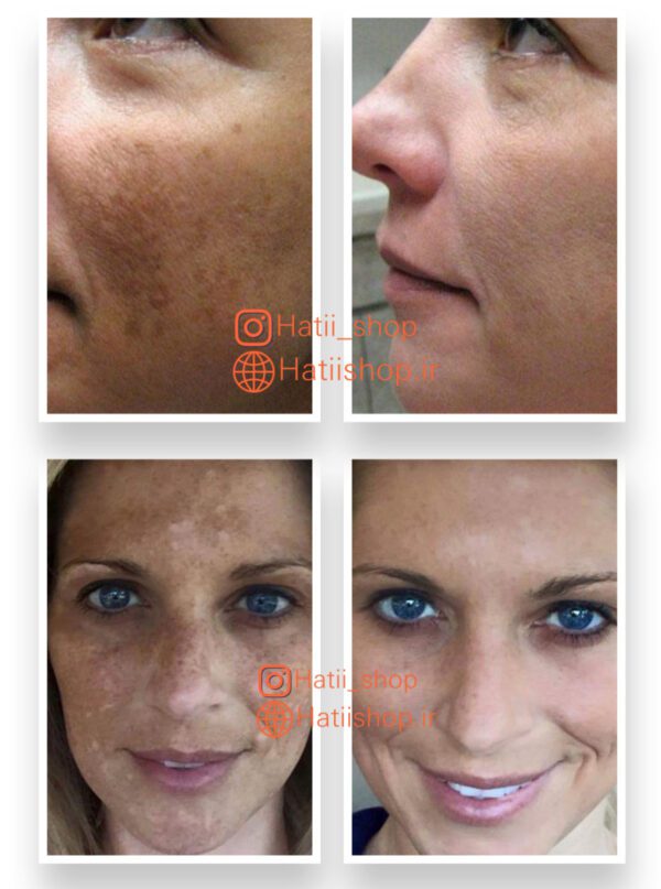 کرم ضد آفتاب ضد لک با محافظت فوق العاده بالا و SPF 50 + آکسول آرسی کازمتیک - Image 4