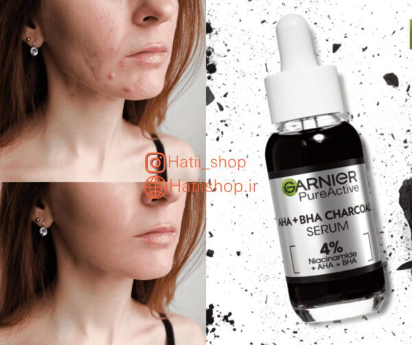 سرم لایه بردار زغال گارنیر حاوی   AHA + BHA - Image 6