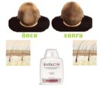 شامپو گیاهی بیوکسین Bioxcin Klasik ضد ریزش مو مناسب موهای چرب 300 میل - Image 2