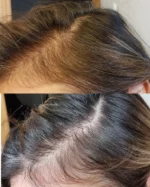 سرم مولتی پپتید اوردینری افزایش تراکم و ضد ریزش مو - Image 5