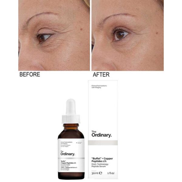 سرم بافه + کوپر پپتید مس 1% اوردینری 30ml - Image 7
