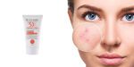 کرم ضد آفتاب و ضد لک اسکن اسکین 40 میلی | مناسب برای پوست چرب و جوشدار با SPF50 - Image 2