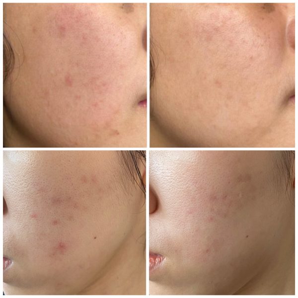 سرم ضد لک و ضد جوش Effaclar لاروش پوزای 30ml - Image 11