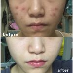سرم ضد لک و ضد جوش Effaclar لاروش پوزای 30ml - Image 12