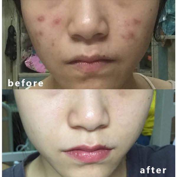 سرم ضد لک و ضد جوش Effaclar لاروش پوزای 30ml - Image 12