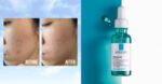 سرم ضد لک و ضد جوش Effaclar لاروش پوزای 30ml - Image 10