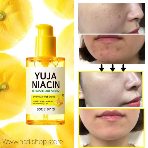 سرم روشن کننده Yuja Niacin سام بای می - Image 10