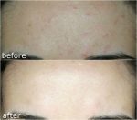 مرطوب کننده پیشرفته حلزون کوزارکس 100 میل - Image 7
