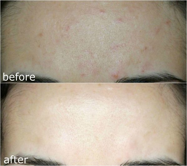 مرطوب کننده پیشرفته حلزون کوزارکس 100 میل - Image 7