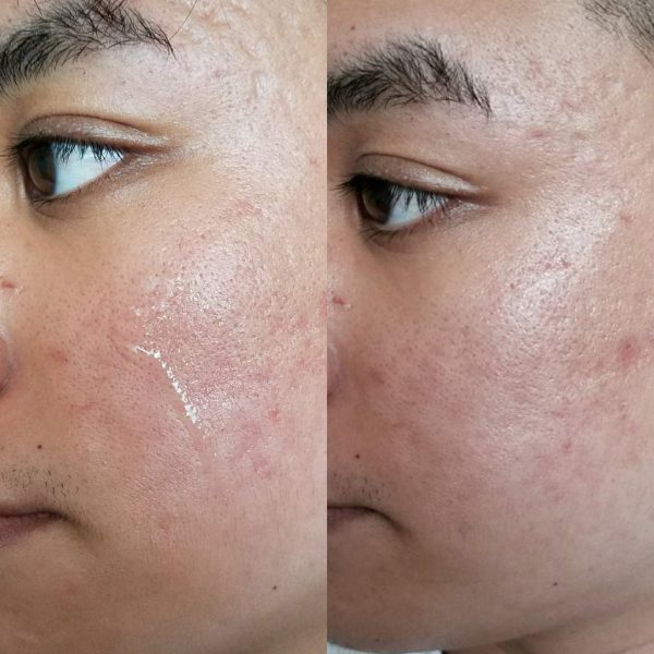 مرطوب کننده پیشرفته حلزون کوزارکس 100 میل - Image 2