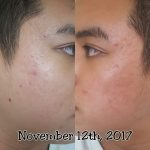 مرطوب کننده پیشرفته حلزون کوزارکس 100 میل - Image 3