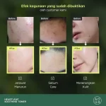 تونر آنوا Anua 77% تسکین دهنده کره ای 250 میل - Image 2