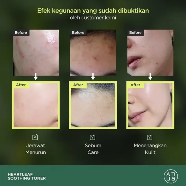 تونر آنوا Anua 77% تسکین دهنده کره ای 250 میل - Image 2