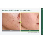 تونر آنوا Anua 77% تسکین دهنده کره ای 250 میل - Image 5