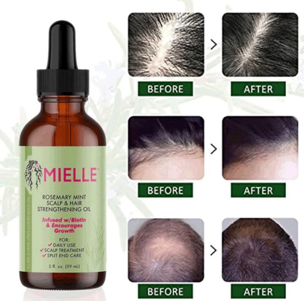 روغن ضد ریزش مو رزماری و نعناع میله Mielle Organics Rosemary Mint Scalp & Hair - Image 7