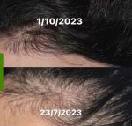 روغن ضد ریزش مو رزماری و نعناع میله Mielle Organics Rosemary Mint Scalp & Hair - Image 12