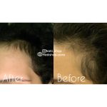 روغن ضد ریزش مو رزماری و نعناع میله Mielle Organics Rosemary Mint Scalp & Hair - Image 8