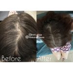روغن ضد ریزش مو رزماری و نعناع میله Mielle Organics Rosemary Mint Scalp & Hair - Image 9
