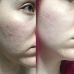 سرم آلفا آربوتین اوردینری